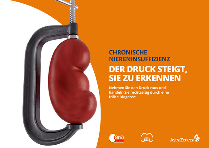 CKD-Leitfaden ansehen